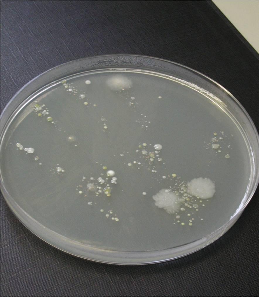 11 Личната хигиена е важна! Снимка: Колонии от микроби върху твърда хранителна среда.