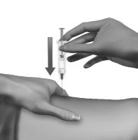Поставяне на инжекцията 1 Почистете и разпънете мястото за инжектиране Ако е необходимо, ползвайте тампони с етанол за обтриване, за да почистите кожата на мястото на инжектиране, което сте подбрали.