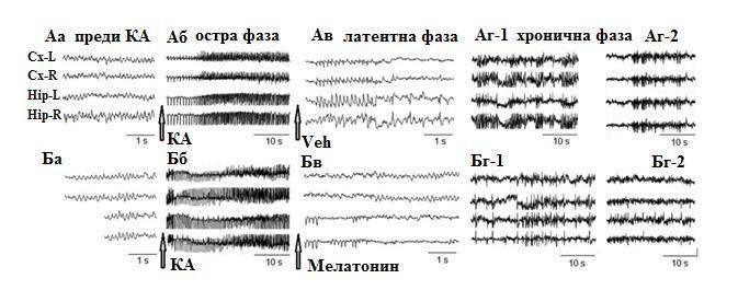 епилептичната група, третирана с мелатонин (KA-mel)- Б; Аа, преди KA: десинхронизация в ЕЕГ записа- активна фаза; Аб, по време на KA-предизвикания ЕС (остра фаза); Ав, по време на латентната фаза: