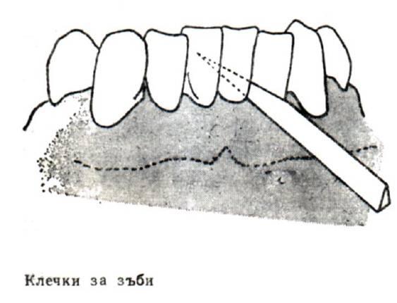 в) зъбни клечки - от дърво - от
