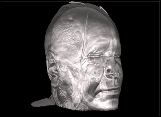 Пример 3D изображение получено от томограф Получените данни от томографа (благодарение на сложен физичен