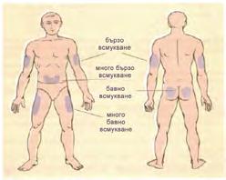 Препоръчван тип игли за на инсулин в зависимост от пола, възрастта и телосложението. Възраст Тип телосложение Препоръчван тип игли Деца до 12 г. всякакво 5 8 мм Мъже 12 18 г.