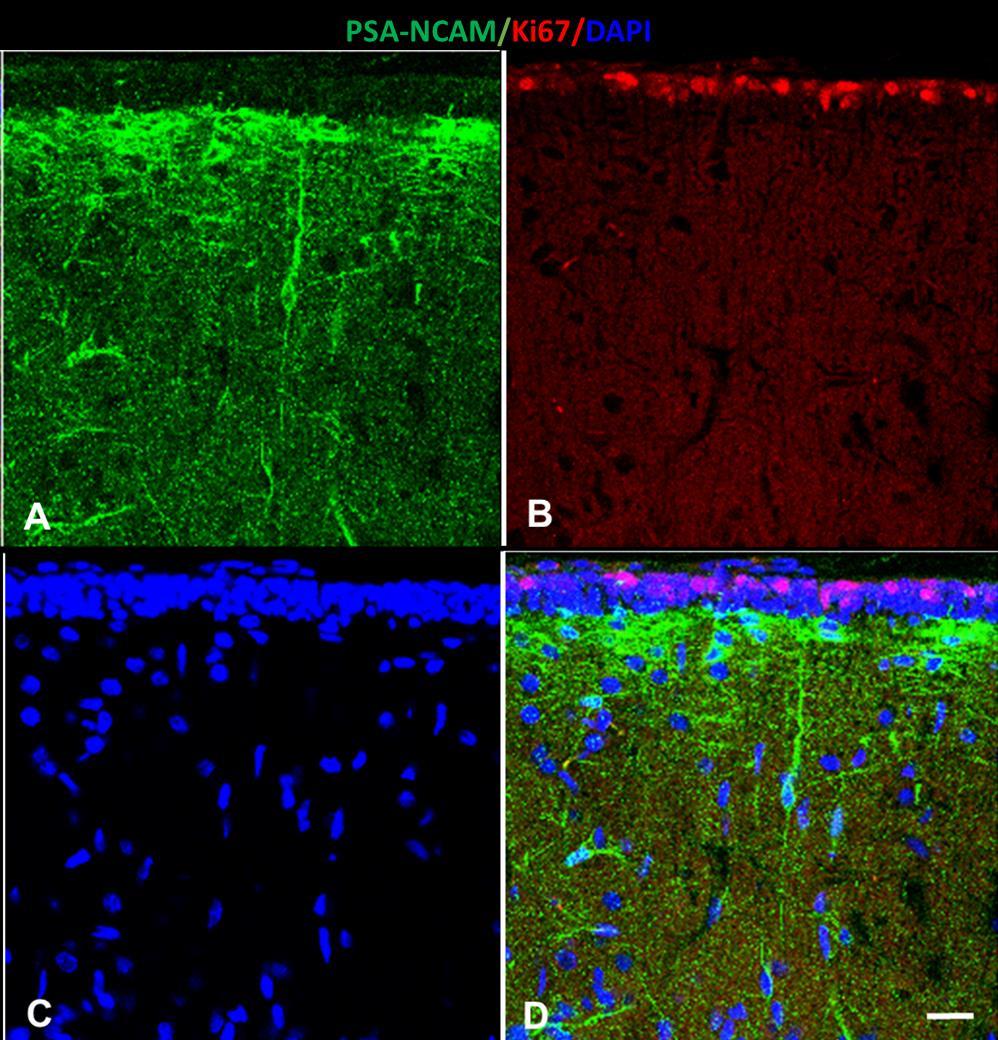 5.4. Фенотип на новообразуваните клетки в малкия мозък във възрастов аспект При анализ на имунофлуорецентните оцветявяния на пробите от малък мозък на новородени животни, маркирани с комбинация от