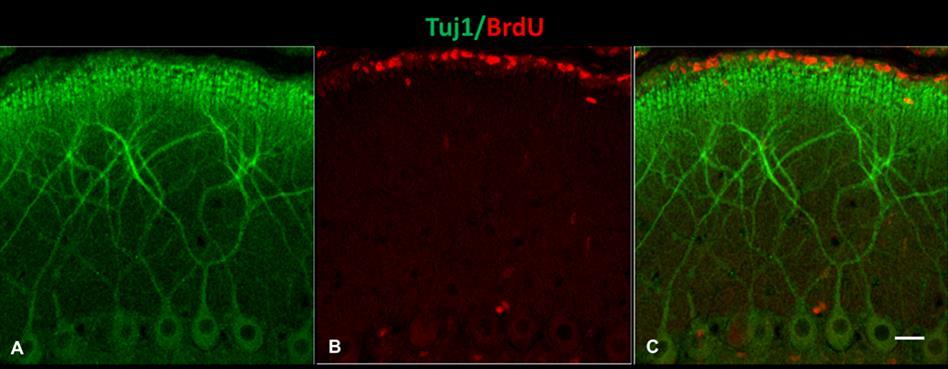 При едногодишните проби липсва колокализация на маркера за клетъчно делене BrdU и невронално специфичния маркер Tuj1 (βiii-tubulin) (Фиг. 5.29)