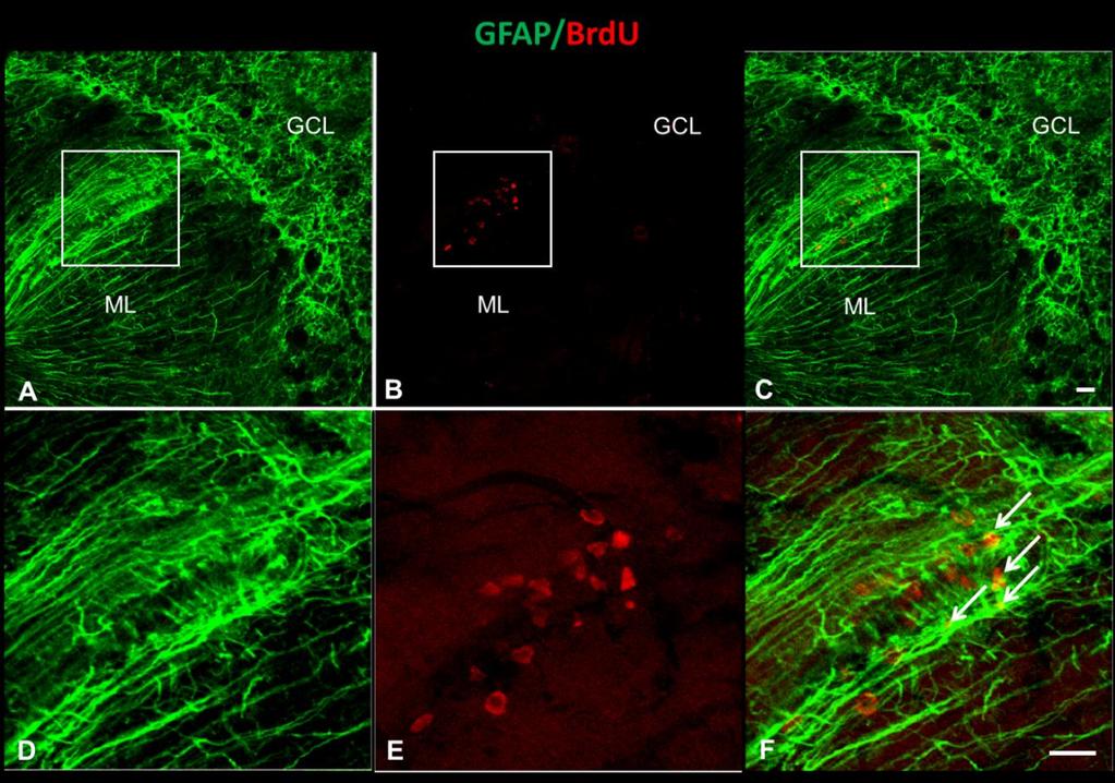Фиг. 5.30. Двойно GFAP/BrdU имунофлуоресцентно оцветяване в кората на малък мозък на маймуна от група D9(+).