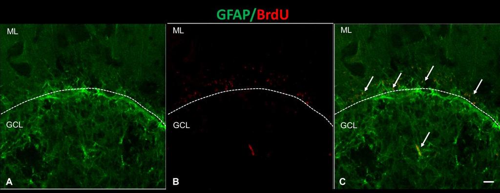 В проба D23(+) също открихме колокализация на BrdU с GFAP (Фиг. 5.32). Фиг. 5.32. Двойно GFAP/BrdU имунофлуоресцентно оцветяване в кората на малък мозък на маймуна от група D23(+).