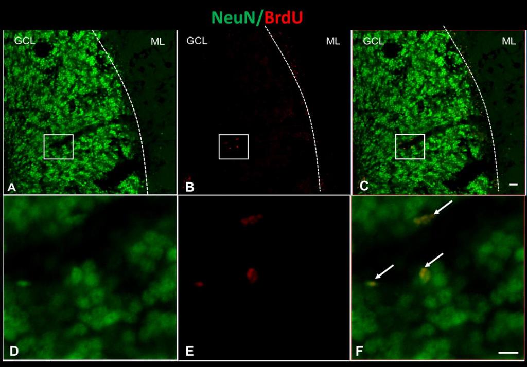 При анализ на група D23(+) се намериха единични клетки с едновременно наличие на клетъчния маркер за постмитотични зрели неврони NeuN (neuron-specific nuclear protein) и BrdU (Фиг. 5.36)