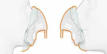 6 Терапия с кислород Маски за средна концентрация Intersurgical кислородна маска, средна концентрация Произведената по най-съвременна технология кислородна маска EcoLite съчетава два несъдържащи PVC