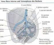 lymphatici iliaci externi nodi lymphatici iliaci interni