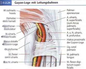Guyon, canalis nervi ulnaris