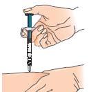 4 - Леко захванете кожата около дезинфектираното място за инжектиране (за да може малко да я повдигнете).