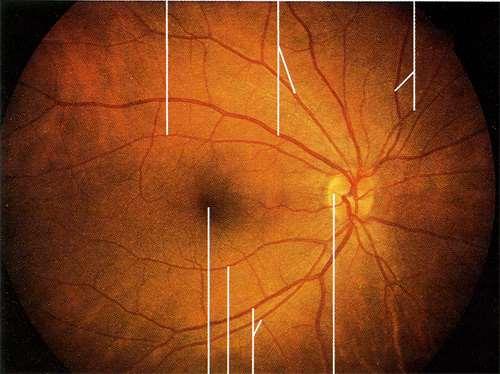 Кръвоснабдяване на ретината a.