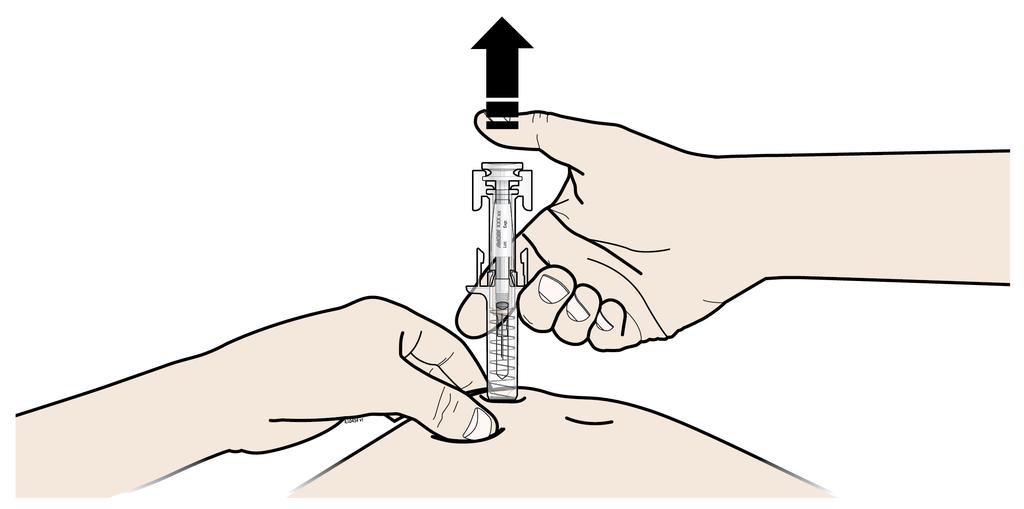 ЩРАКВАНЕ Важно е да натискате надолу по време на щракването, за да доставите пълната доза. В ОТПУСНЕТЕ палеца си.
