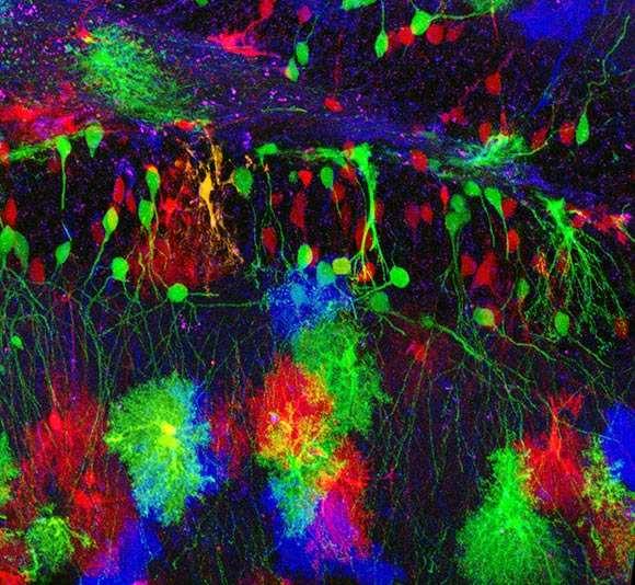 Биоестетика: цветовете на мозъка астроцити: