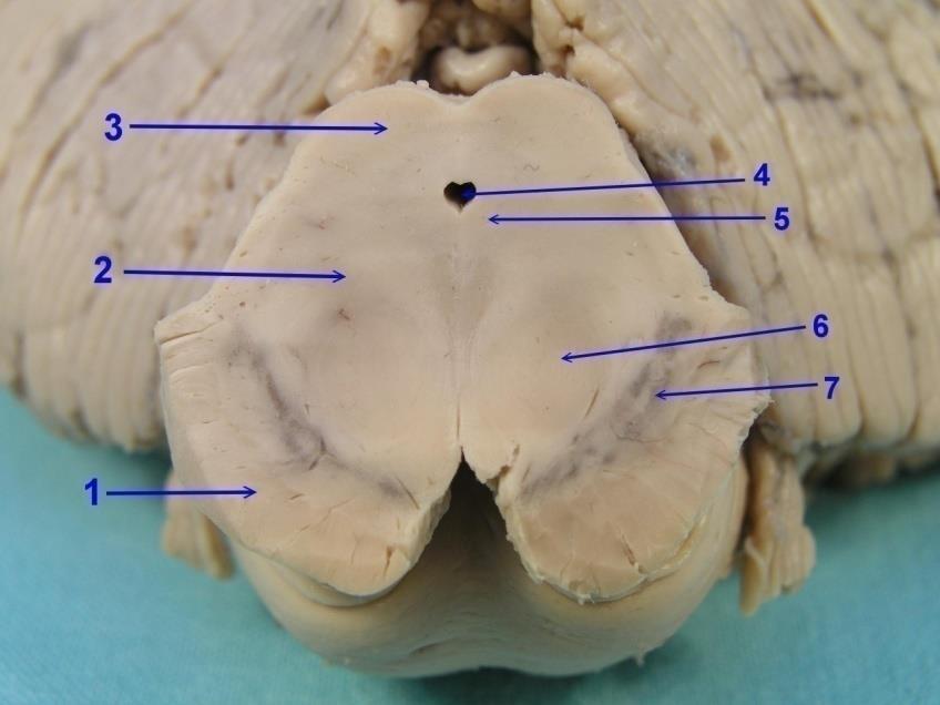 развива се от средното мехурче (mesencephalon) между diencephalon и pons Подялба: Pedunculus cerebri crus cerebri (1)