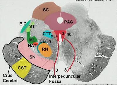 Тегментум - релейни ядра от ЕПС: Substantia nigra - съдържа невромеланин; - произвежда dopamine за инхибиране на възбудните импулси на базалните