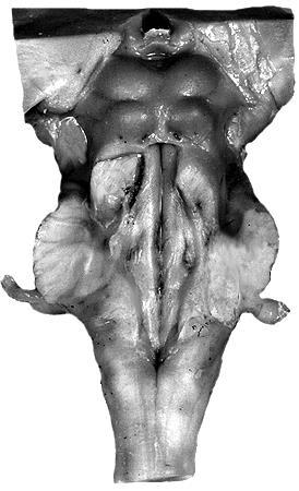 Colliculus rostralis Colliculus caudalis Pedunculus cerebellaris rostralis