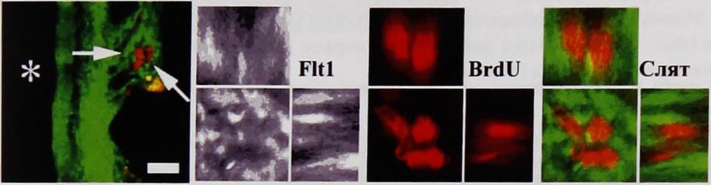 наблюдаваха (Фиг. 4.54). Фиг. 4.54. Двойно имунофлуо-ресцентно оцветяване за F ltl/brdu в стриатална SVZa на ден 9 след исхемия.