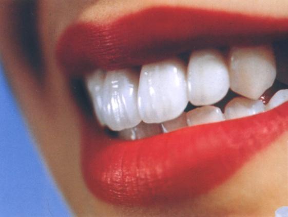 Изборът на изкуствени зъби е субективен процес, роля има и мнението на пациента. Най-разпространена е правоъгълната форма 47% и е по-характерна за мъжете.