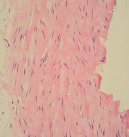 Репрезантативна фотомикрограма на аортна стена (тънка стрелка ендотел; дебела стрелка медия) на WKY
