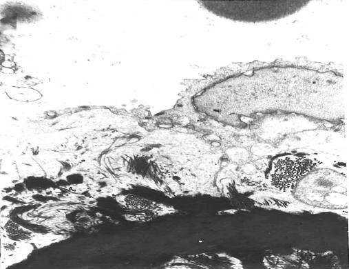 Репрезентативна фотомикрограма на участък oт аортна стена на WKY на 4месечна възраст ув. х6000 Фиг. 15. Репрезантативна фотомикрограма на електронно-микроскопско изследване на аортна стена на WKY.