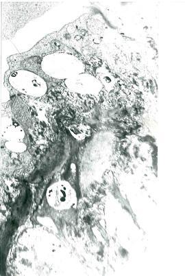 са показани репрезентативни фотомикрограми от електронномикроскопското изследване на аортна стена на плъховете WKY на различни селенови диети на 8 месечна възраст.