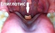 Надгръклянник* (epiglottis) Той представлява еластичен хрущял с форма на крушов лист, който