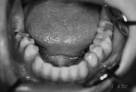 dentition is an obvious reason to advance in this area of oral biology.