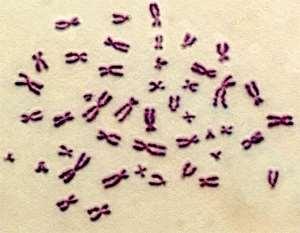 анеуплодия размери структура Метафазни хромозоми banding
