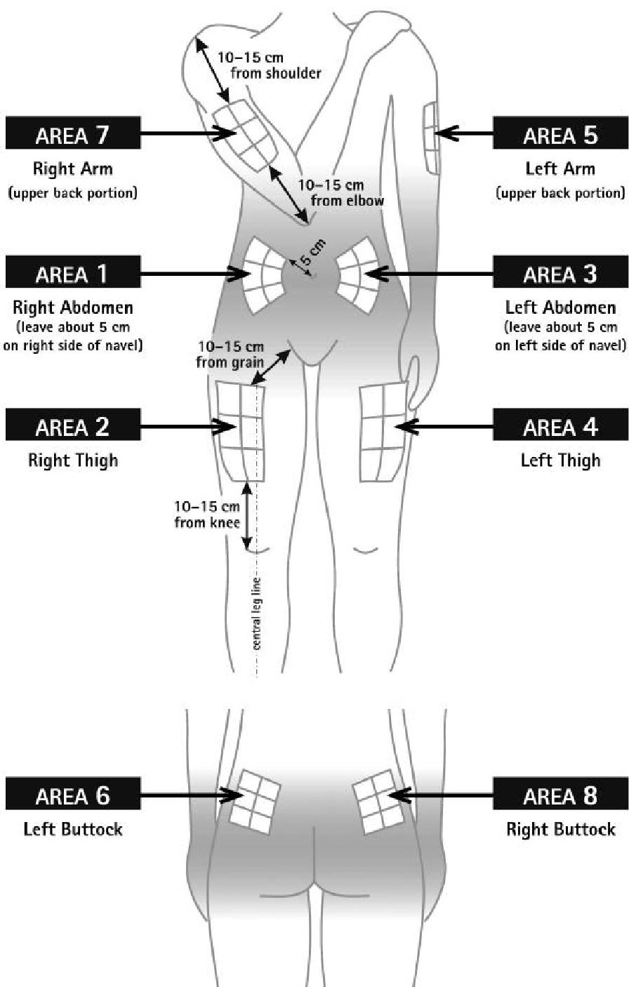 срединна линия на крака РОТАЦИОННА СХЕМА 10-15 cm от рамото ЗОНА 1 Дясна ръка (горна задна страна) 10-15 cm от лакътя ЗОНА 2 Лява ръка (горна задна страна) ЗОНА 3 Дясна коремна област (оставете около