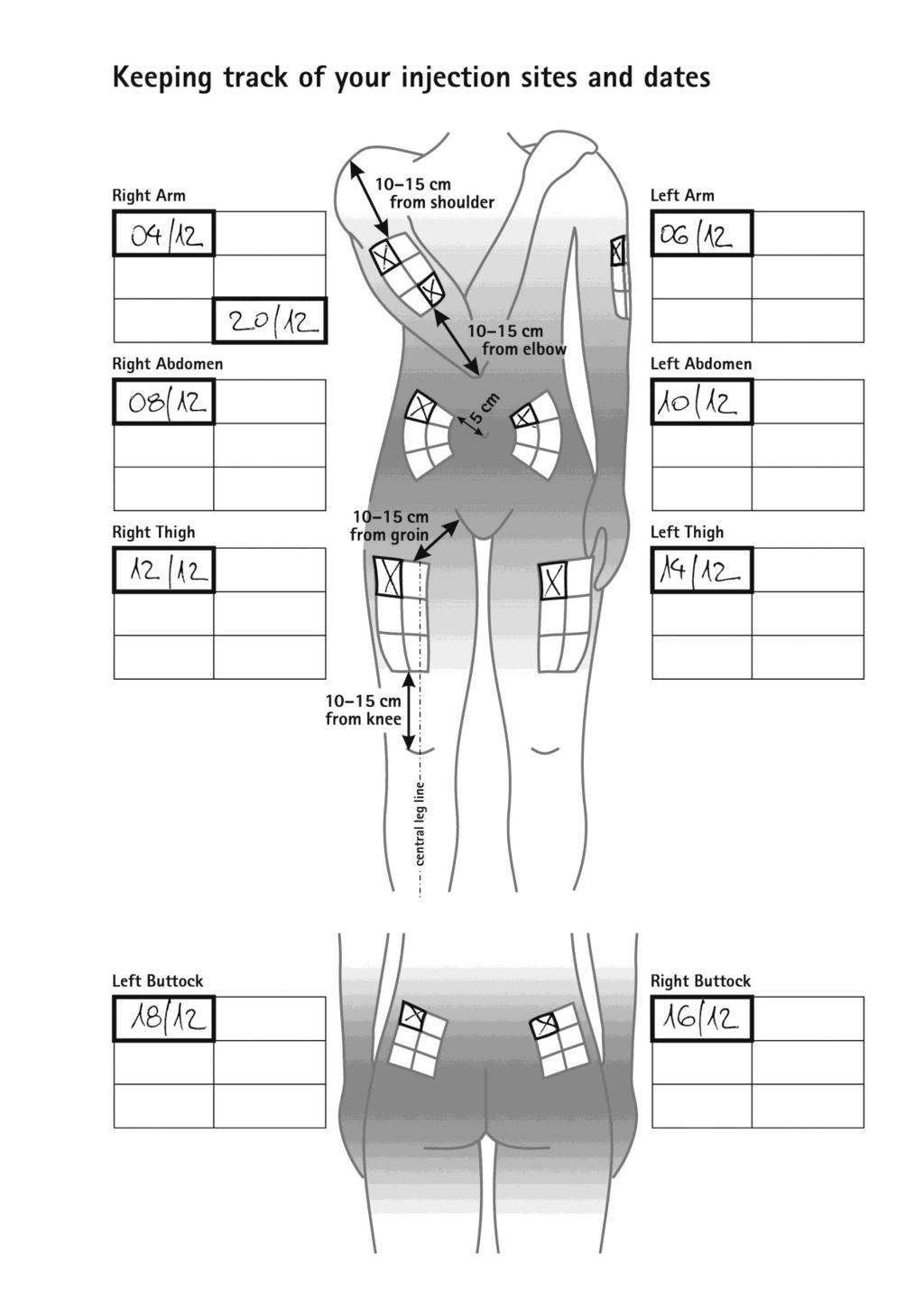 срединна линия на крака ПРИМЕРНА МЕДИЦИНСКА КАРТА: Отбелязване на местата и датите на инжектиране Дясна ръка 10-15 cm от рамото Лява ръка Дясна коремна