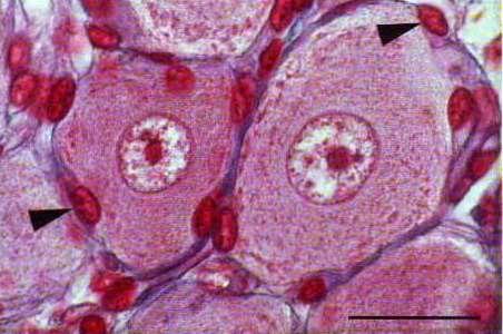 Периферни глиоцити Шванови клетки