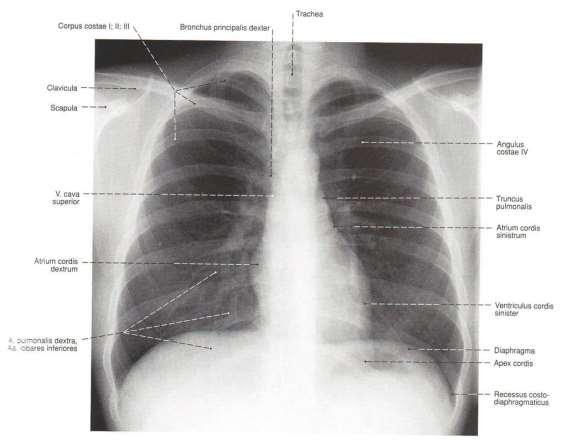 Сърце рентгенова анатомия