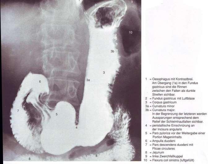 Стомах: рентгенова анатомия Saccus digestorius: fornix gastricus corpus gastricum