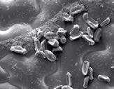 тъканите, така и вътре в тях. Кантус има отлично действие срещу гъбни патогени от класовете Ascomycetes и Deuteromycetes.